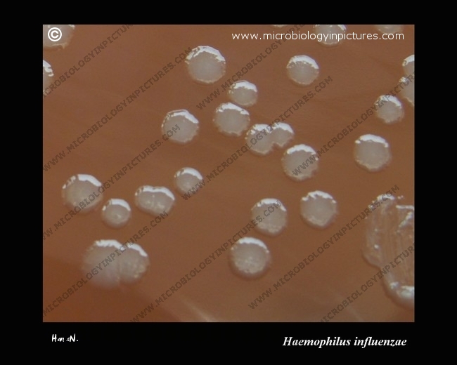 h.influenzae colonies on chocolate agar